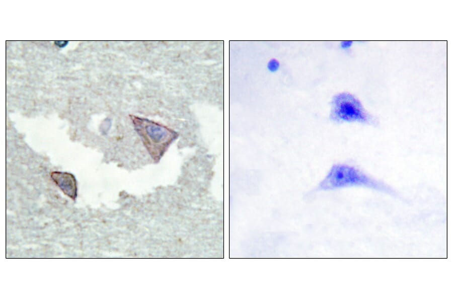 Immunohistochemistry - Anti-PDGFR alpha (phospho Tyr754) Antibody (A0969) - Antibodies.com