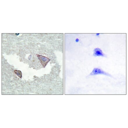 Immunohistochemistry - Anti-PDGFR alpha (phospho Tyr754) Antibody (A0969) - Antibodies.com