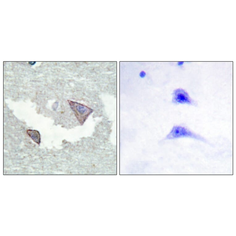 Immunohistochemistry - Anti-PDGFR alpha (phospho Tyr754) Antibody (A0969) - Antibodies.com