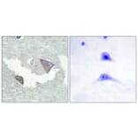 Immunohistochemistry - Anti-PDGFR alpha (phospho Tyr754) Antibody (A0969) - Antibodies.com