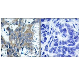 Immunohistochemistry - Anti-Catenin-beta (phospho Ser33) Antibody (A7022) - Antibodies.com