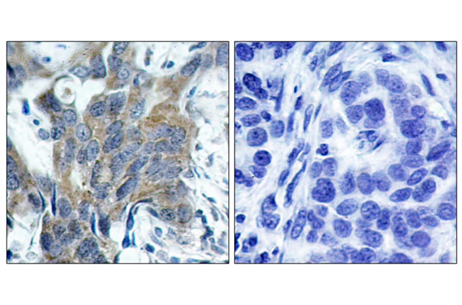 Immunohistochemistry - Anti-Catenin-beta (phospho Ser33) Antibody (A7022) - Antibodies.com