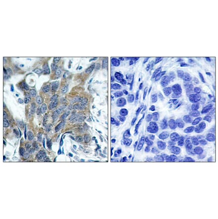 Immunohistochemistry - Anti-Catenin-beta (phospho Ser33) Antibody (A7022) - Antibodies.com