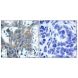 Immunohistochemistry - Anti-Catenin-beta (phospho Ser33) Antibody (A7022) - Antibodies.com