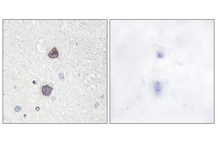 Immunohistochemistry - Anti-Aquaporin 2 (phospho Ser256) Antibody (A0768) - Antibodies.com