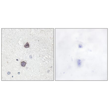 Immunohistochemistry - Anti-Aquaporin 2 (phospho Ser256) Antibody (A0768) - Antibodies.com