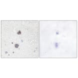 Immunohistochemistry - Anti-Aquaporin 2 (phospho Ser256) Antibody (A0768) - Antibodies.com