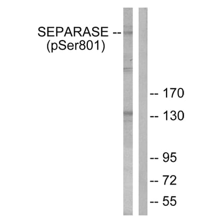 Western Blot - Anti-SEPARASE (phospho Ser801) Antibody (A0086) - Antibodies.com