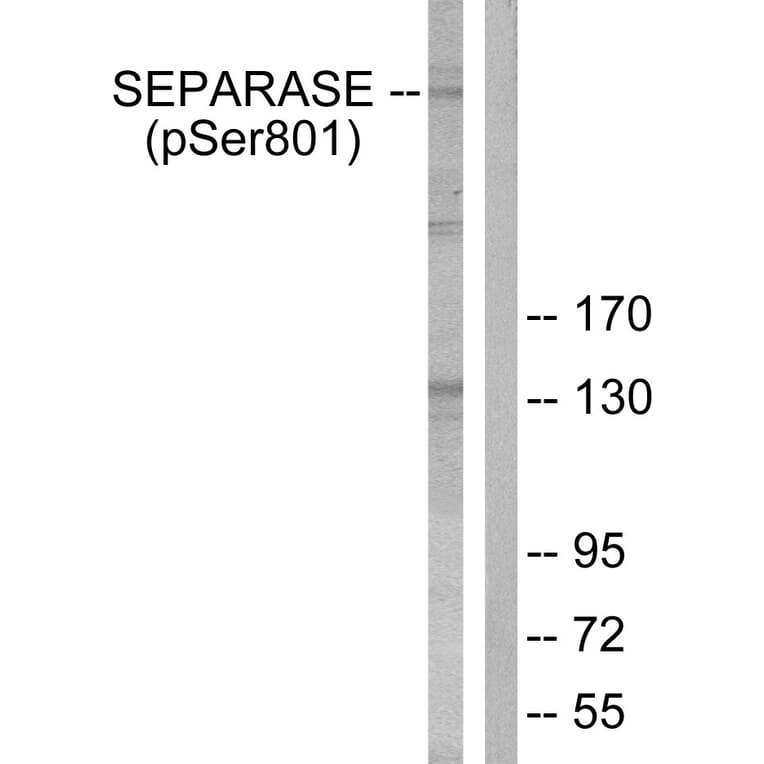 Western Blot - Anti-SEPARASE (phospho Ser801) Antibody (A0086) - Antibodies.com