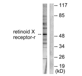 Western Blot - Anti-Retinoid X Receptor gamma Antibody (C0316) - Antibodies.com