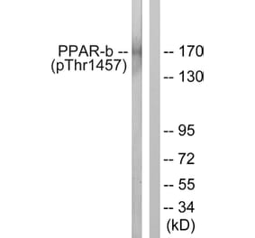 Western Blot - Anti-PPAR-BP (phospho Thr1457) Antibody (A0556) - Antibodies.com