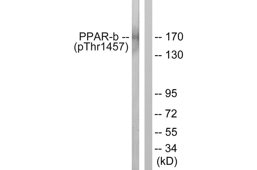 Western Blot - Anti-PPAR-BP (phospho Thr1457) Antibody (A0556) - Antibodies.com