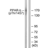 Western Blot - Anti-PPAR-BP (phospho Thr1457) Antibody (A0556) - Antibodies.com
