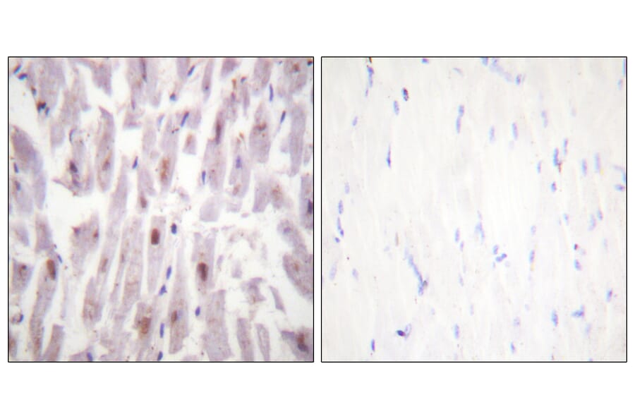 Immunohistochemistry - Anti-PPAR-BP (phospho Thr1457) Antibody (A0556) - Antibodies.com
