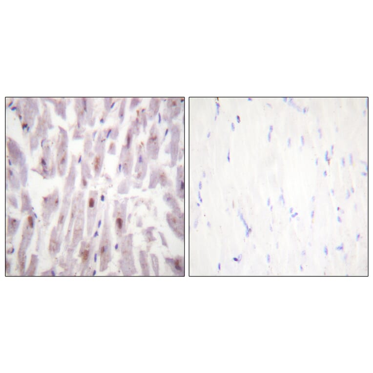 Immunohistochemistry - Anti-PPAR-BP (phospho Thr1457) Antibody (A0556) - Antibodies.com