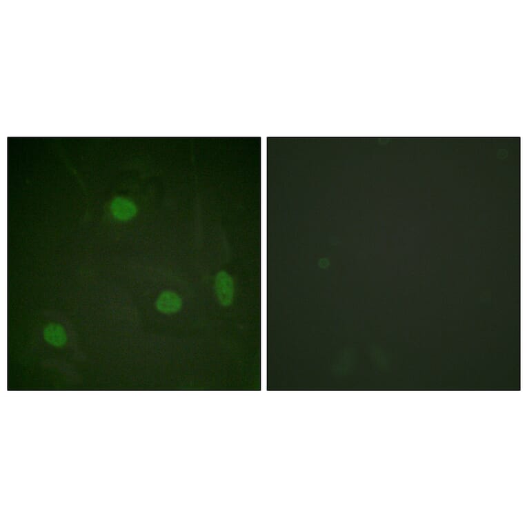 Immunofluorescence - Anti-Histone H3 (acetyl Lys23) Antibody (D0009) - Antibodies.com