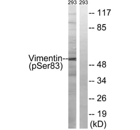 Western Blot - Anti-Vimentin (phospho Ser83) Antibody (A1242) - Antibodies.com