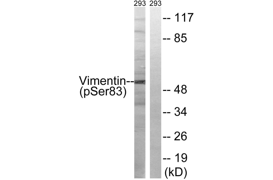 Western Blot - Anti-Vimentin (phospho Ser83) Antibody (A1242) - Antibodies.com