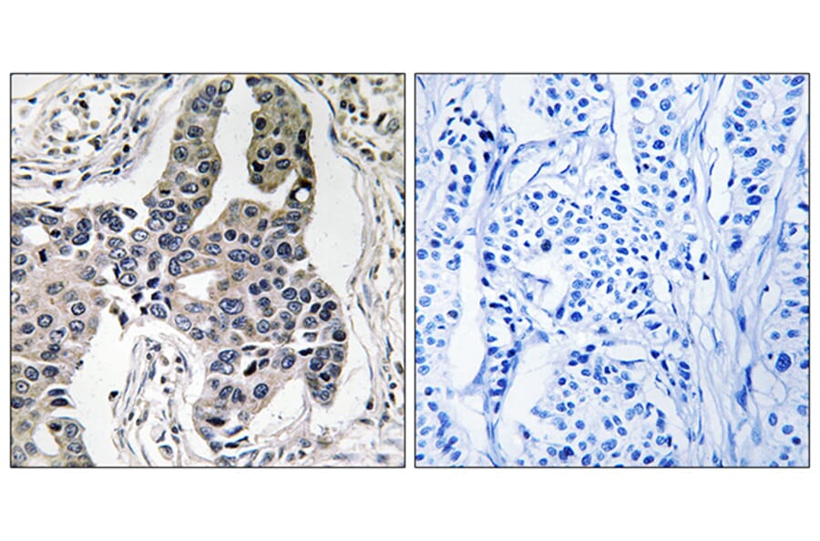 Immunohistochemistry - Anti-Vimentin (phospho Ser83) Antibody (A1242) - Antibodies.com