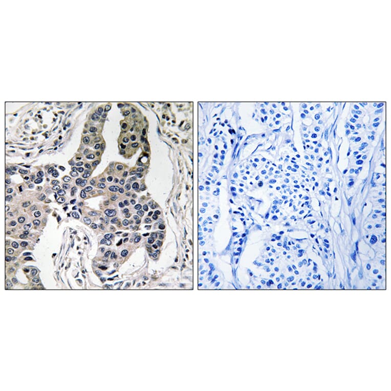 Immunohistochemistry - Anti-Vimentin (phospho Ser83) Antibody (A1242) - Antibodies.com