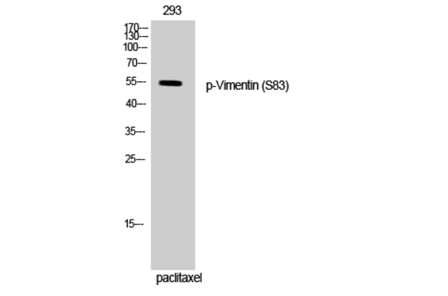 Western Blot - Anti-Vimentin (phospho Ser83) Antibody (A1242) - Antibodies.com