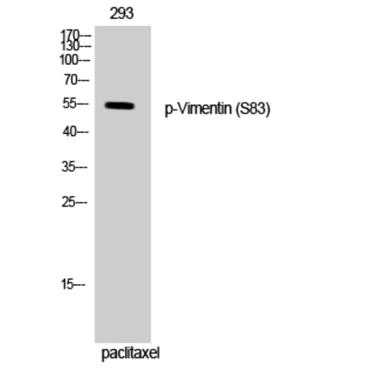 Western Blot - Anti-Vimentin (phospho Ser83) Antibody (A1242) - Antibodies.com