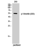 Western Blot - Anti-Vimentin (phospho Ser83) Antibody (A1242) - Antibodies.com