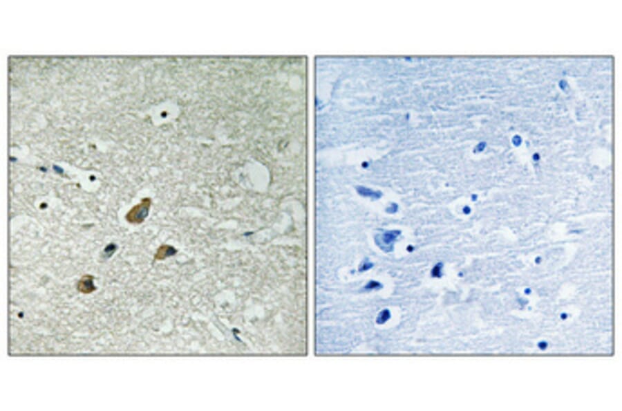 Immunohistochemistry - Anti-Vimentin (phospho Ser83) Antibody (A1242) - Antibodies.com