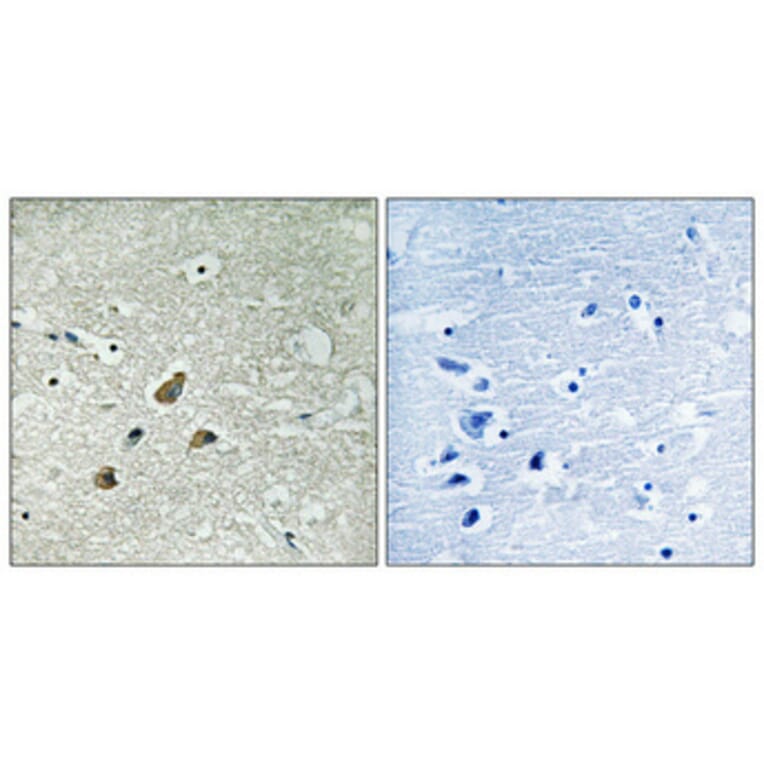 Immunohistochemistry - Anti-Vimentin (phospho Ser83) Antibody (A1242) - Antibodies.com