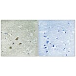 Immunohistochemistry - Anti-Vimentin (phospho Ser83) Antibody (A1242) - Antibodies.com