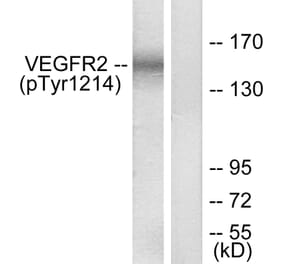 Western Blot - Anti-VEGFR2 (phospho Tyr1214) Antibody (A7253) - Antibodies.com