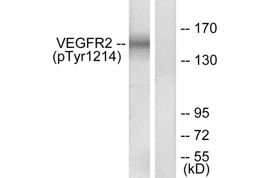 Western Blot - Anti-VEGFR2 (phospho Tyr1214) Antibody (A7253) - Antibodies.com