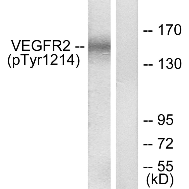 Western Blot - Anti-VEGFR2 (phospho Tyr1214) Antibody (A7253) - Antibodies.com