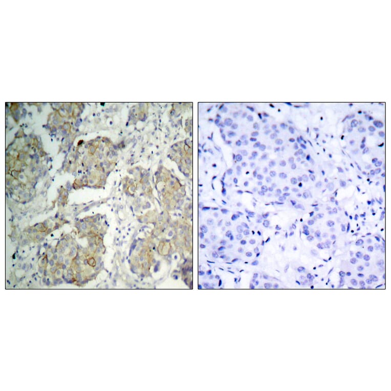 Immunohistochemistry - Anti-VEGFR2 (phospho Tyr1214) Antibody (A7253) - Antibodies.com