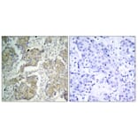 Immunohistochemistry - Anti-VEGFR2 (phospho Tyr1214) Antibody (A7253) - Antibodies.com