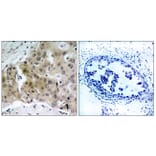 Immunohistochemistry - Anti-VEGFR2 (phospho Tyr1175) Antibody (A7252) - Antibodies.com