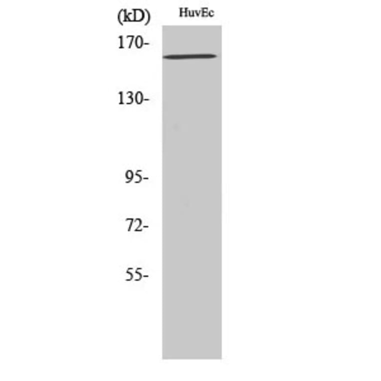 Western Blot - Anti-VEGFR2 (phospho Tyr1175) Antibody (A7252) - Antibodies.com