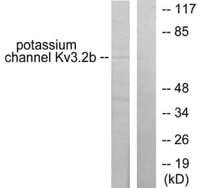 Western Blot - Anti-Potassium Channel Kv3.2b Antibody (C0307) - Antibodies.com