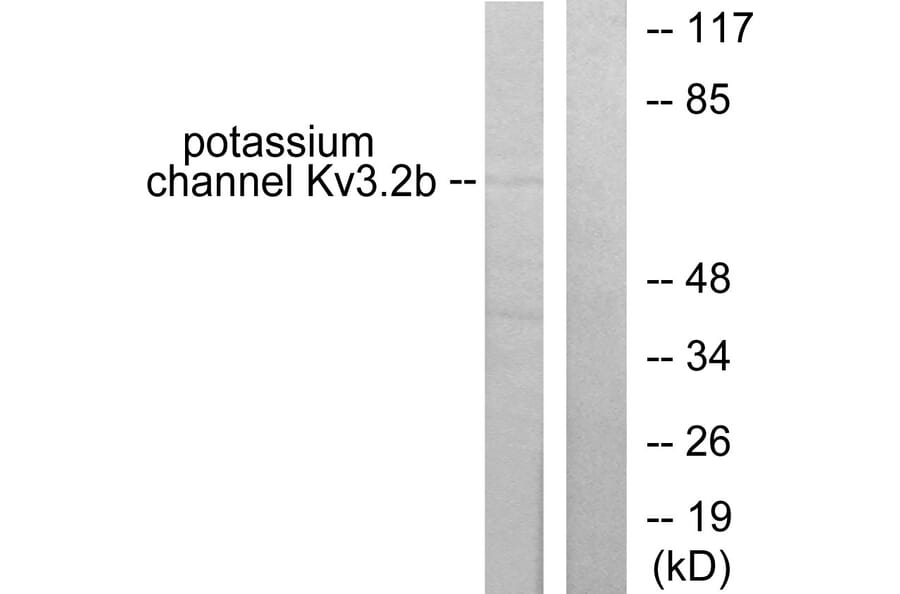 Western Blot - Anti-Potassium Channel Kv3.2b Antibody (C0307) - Antibodies.com