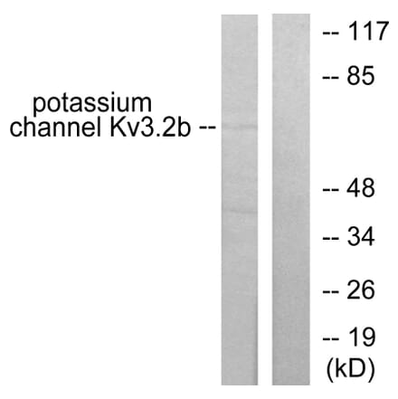 Western Blot - Anti-Potassium Channel Kv3.2b Antibody (C0307) - Antibodies.com