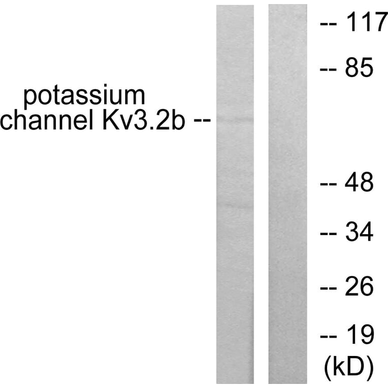 Western Blot - Anti-Potassium Channel Kv3.2b Antibody (C0307) - Antibodies.com