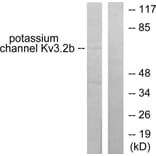 Western Blot - Anti-Potassium Channel Kv3.2b Antibody (C0307) - Antibodies.com