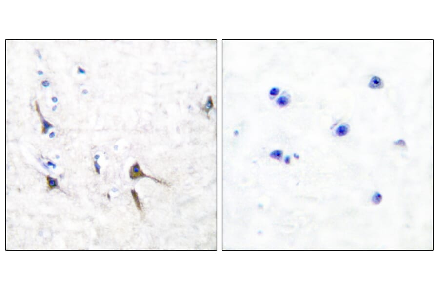 Immunohistochemistry - Anti-Potassium Channel Kv3.2b Antibody (C0307) - Antibodies.com