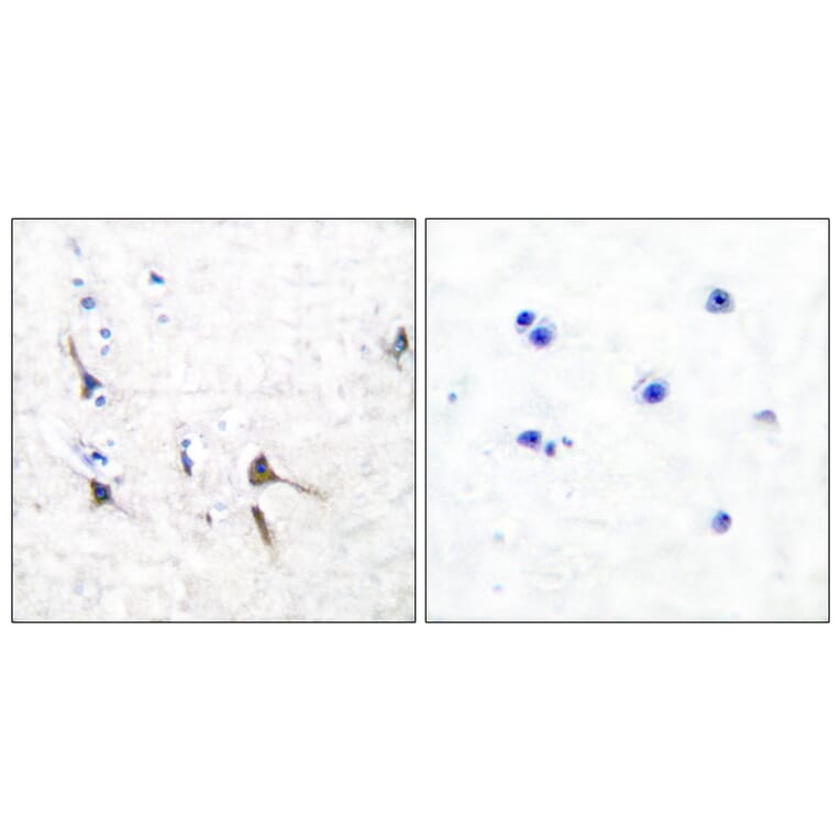 Immunohistochemistry - Anti-Potassium Channel Kv3.2b Antibody (C0307) - Antibodies.com