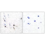 Immunohistochemistry - Anti-Potassium Channel Kv3.2b Antibody (C0307) - Antibodies.com
