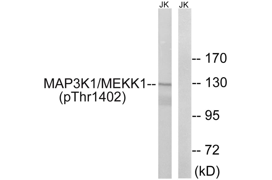 Western Blot - Anti-MAP3K1 (phospho Thr1402) Antibody (A8129) - Antibodies.com
