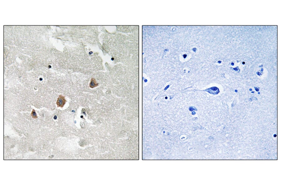 Immunohistochemistry - Anti-MAP3K1 (phospho Thr1402) Antibody (A8129) - Antibodies.com