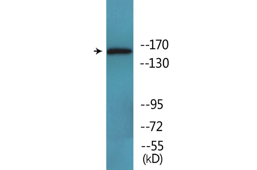 Western Blot - Anti-MAP3K1 (phospho Thr1402) Antibody (P12-1141) - Antibodies.com