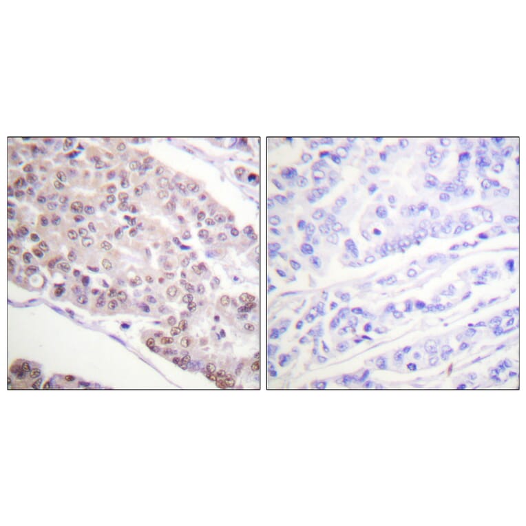 Immunohistochemistry - Anti-Histone H4 (acetyl Lys8) Antibody (D0012) - Antibodies.com