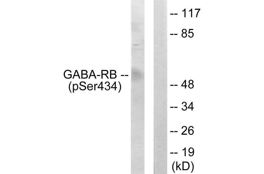 Western Blot - Anti-GABA-RB (phospho Ser434) Antibody (A0011) - Antibodies.com